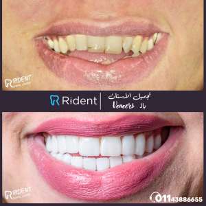 أسعار