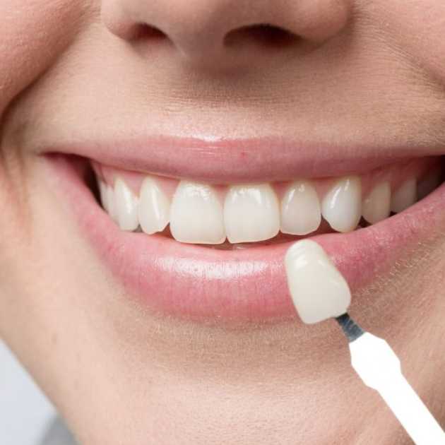 أنواع تركيبات الاسنان