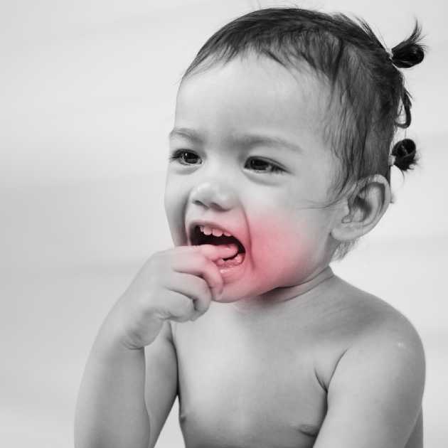أعراض تسوس اسنان الاطفال