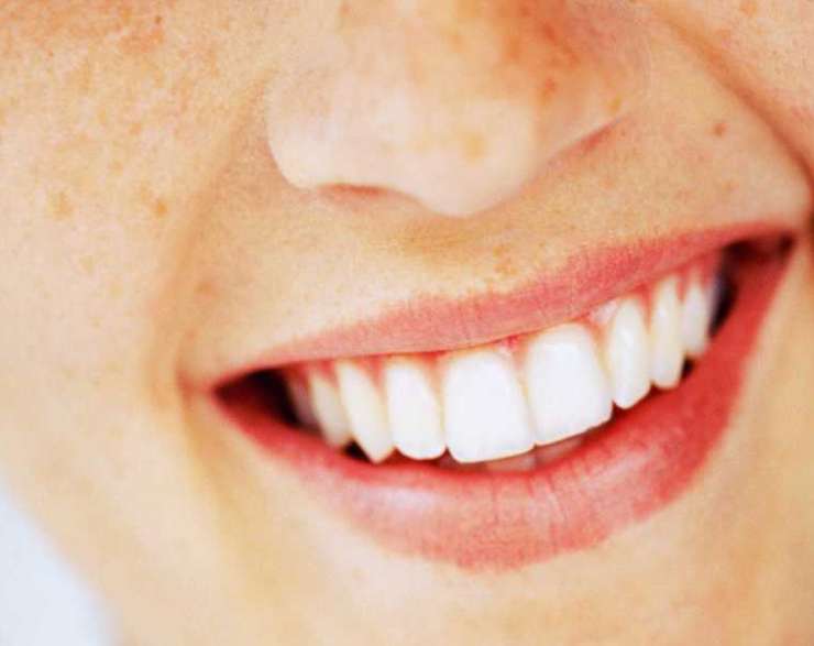 أهم 6 أسئلة وإجابات عن شكل الاسنان الطبيعي