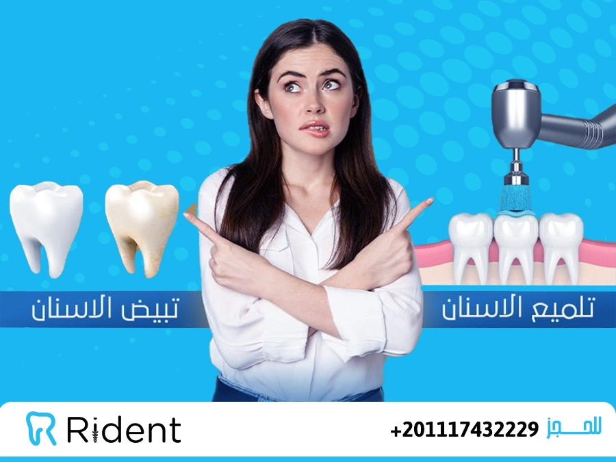 الفرق بين تبييض وتلميع الاسنان ؟