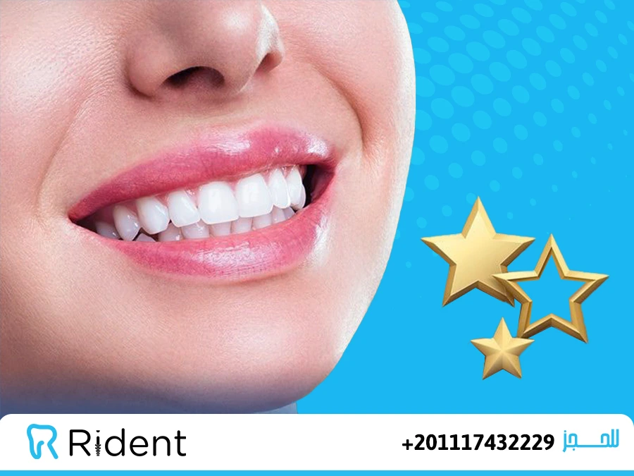 مركز اسنان Rident
